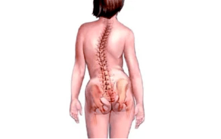 a nyaki osteochondrosis kialakulásának okai