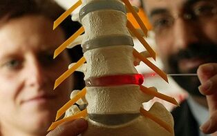 A mellkasi gerinc osteokondrózisának tünetei és kezelése